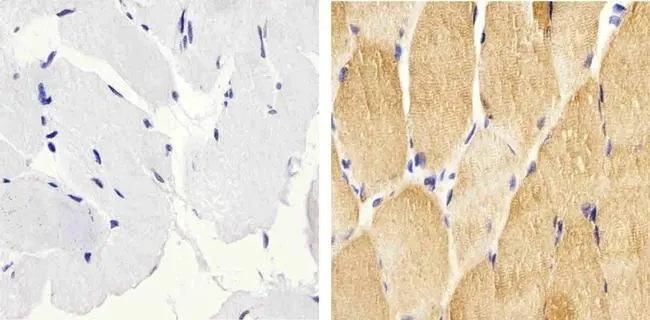 IHC-P analysis of human skeletal muscle tissue using GTX17937 HSP27 (phospho Ser82) antibody. Right : Primary antibody Left : Negative control without primary antibody Antigen retrieval : 10mM sodium citrate (pH 6.0), microwaved for 8-15 min Dilution : 1:100 IHC-P analysis of human skeletal muscle tissue using GTX17937 HSP27 (phospho Ser82) antibody. Right : Primary antibody Left : Negative control without primary antibody Antigen retrieval : 10mM sodium citrate (pH 6.0), microwaved for 8-15 min Dilution : 1:100