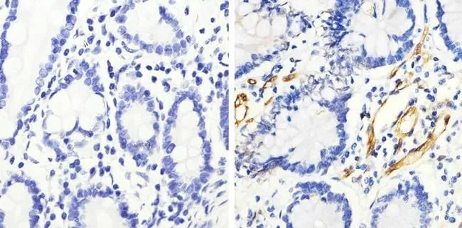 IHC-P analysis of human small intestine tissue using GTX17937 HSP27 (phospho Ser82) antibody. Right : Primary antibody Left : Negative control without primary antibody Antigen retrieval : 10mM sodium citrate (pH 6.0), microwaved for 8-15 min Dilution : 1:100