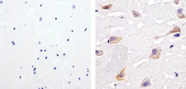 IHC-P analysis of human brain tissue using GTX17939 SHP2 (phospho Tyr542) antibody. Right : Primary antibody Left : Negative control without primary antibody Antigen retrieval : 10mM sodium citrate (pH 6.0), microwaved for 8-15 min Dilution : 1:20 IHC-P analysis of human brain tissue using GTX17939 SHP2 (phospho Tyr542) antibody. Right : Primary antibody Left : Negative control without primary antibody Antigen retrieval : 10mM sodium citrate (pH 6.0), microwaved for 8-15 min Dilution : 1:20