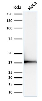 WB analysis of HeLa cell lysate using GTX17952 Emerin antibody [EMD/2168].