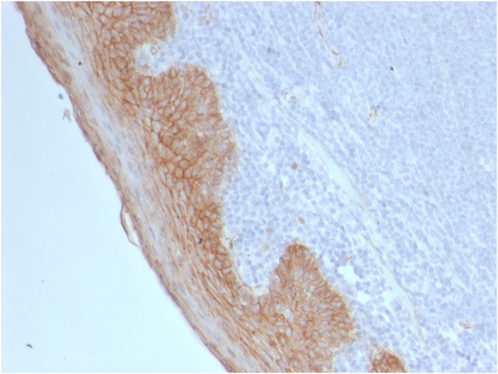 IHC-P analysis of human tonsil tissue using GTX17954 beta Catenin antibody [CTNNB1/2098].