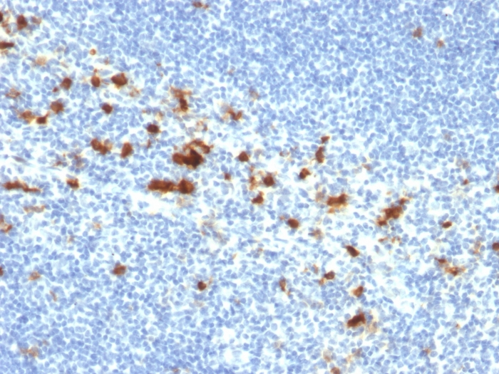 IHC-P analysis of human tonsil tissue using GTX17969 Integrin alpha E antibody [ITGAE/2474].