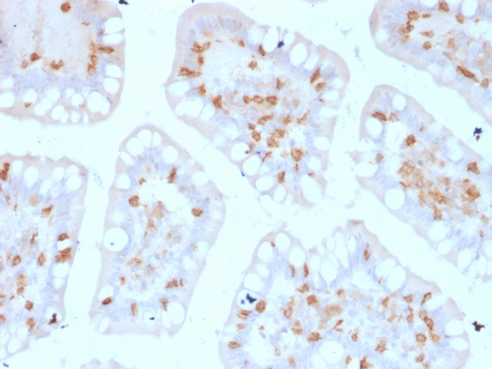 IHC-P analysis of human colon tissue using GTX17969 Integrin alpha E antibody [ITGAE/2474].