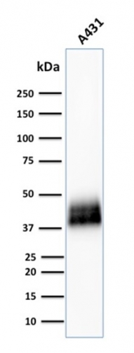 WB analysis of A431 cell lysate using GTX17970 TACSTD2 antibody [TACSTD2/2151].