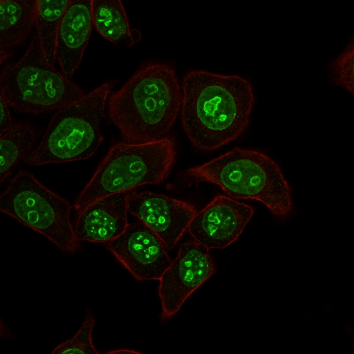 ICC/IF analysis of HeLa cells using GTX17971 Ki67 antibody [MKI67/2462]. Green : Primary antibody Red : Phalloidin