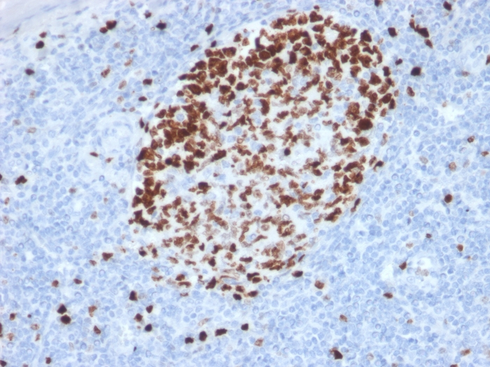 IHC-P analysis of human tonsil tissue using GTX17971 Ki67 antibody [MKI67/2462].