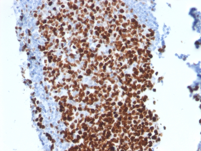IHC-P analysis of human tonsil tissue using GTX17971 Ki67 antibody [MKI67/2462].