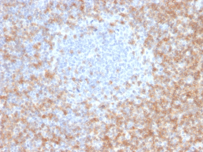 IHC-P analysis of human tonsil tissue using GTX18024 CD5 antibody [CD5/2416].