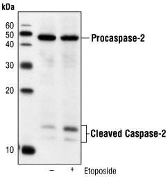 WB analysis of untreated or etoposide-treated Jurkat cell lysate using GTX18029 Caspase 2 antibody [4i13(C2)].