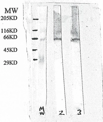 Western blot analysis of mouse brain extract (20ug/lane total protein) with chicken anti presenilin 1 (Lane 2) and chicken anti presenilin 2 (GTX18041) (Lane 3) Western blot analysis of mouse brain extract (20ug/lane total protein) with chicken anti presenilin 1 (Lane 2) and chicken anti presenilin 2 (GTX18041) (Lane 3)