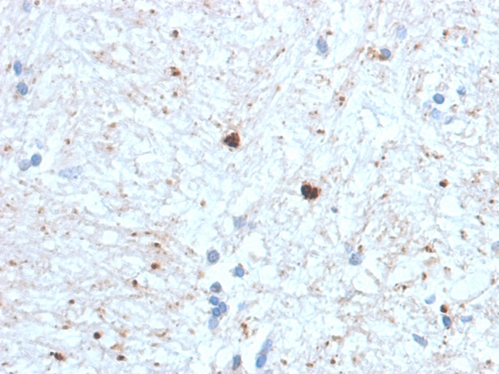 IHC-P analysis of human brain tissue using GTX18045 Ubiquitin antibody [UBB/1748].