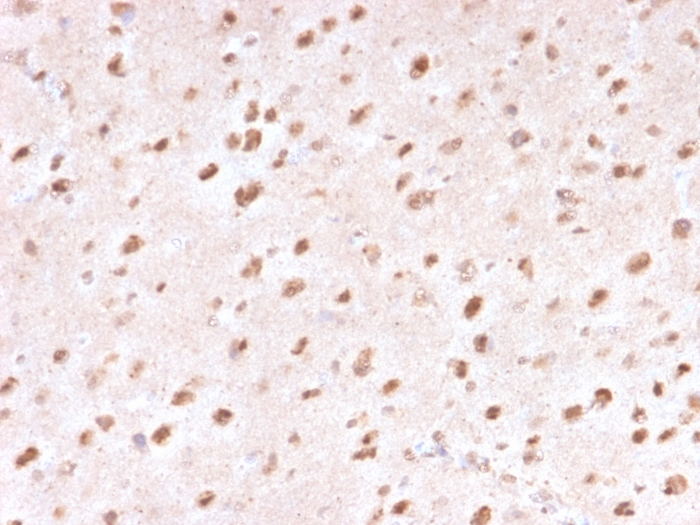 IHC-P analysis of human brain tissue using GTX18045 Ubiquitin antibody [UBB/1748].