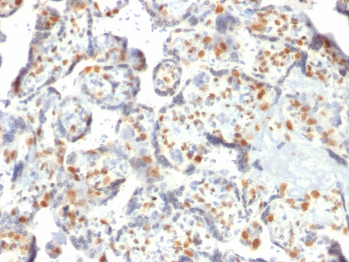 IHC-P analysis of human placenta tissue using GTX18052 DNMT3A antibody [PCRP-DNMT3A-1E2].