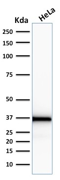 WB analysis of HeLa cell lysate using GTX18054 Emerin antibody [EMD/2167].