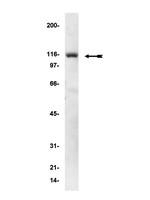 WB analysis of A431 cell lysate using GTX18061 alpha Actinin 1 antibody [0.T.02].