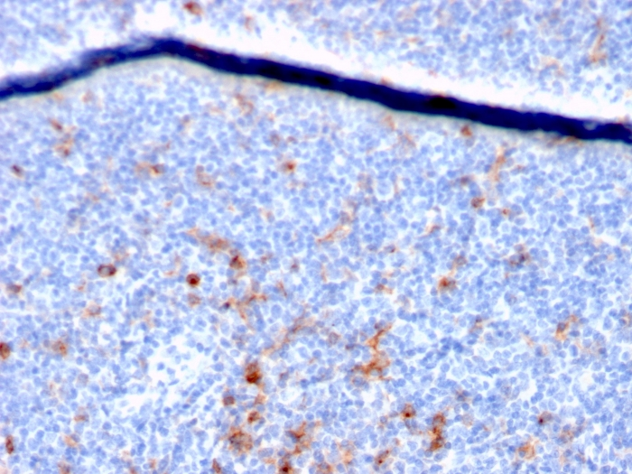 IHC-P analysis of human tonsil tissue using GTX18115 IL2 Receptor alpha antibody [IL2RA/2395].