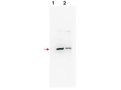WB analysis of various samples using GTX18150 FBXW11 antibody. Lane 1 : NIH-3T3 whole cell lysate Lane 2 : 293T whole cell lysate Dilution : 1 :200