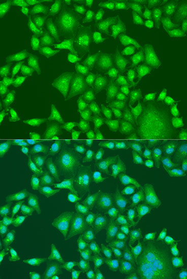ICC/IF analysis of U2OS cells using GTX18153 PTEN antibody.<br>Blue : DAPI<br>Dilution : 1:100