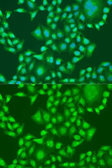 ICC/IF analysis of U2OS cells using GTX18153 PTEN antibody. Blue : DAPI Dilution : 1:100