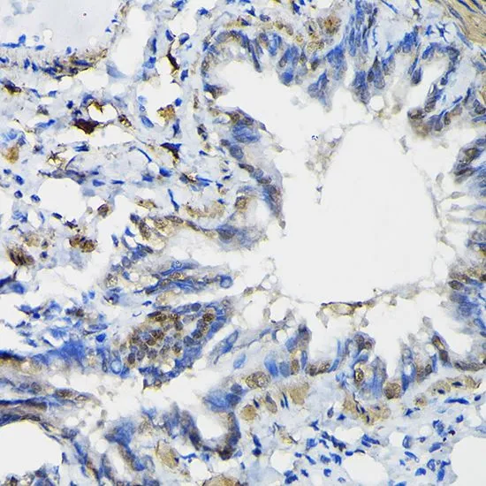 IHC-P analysis of rat lung tissue using GTX18153 PTEN antibody. Dilution : 1:100
