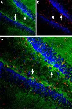 IHC-Frfl (free floating) analysis of perfusion-fixed rat hippocampus tissue using GTX18175 EAAT1 antibody. DAPI is used as a general cell marker (blue). Panel A : EAAT1 staining (green) is particularly intense along the subgranular layer (arrows) Panel B : Staining with mouse anti glial fibrillary acidic protein (red) Panel C : Merged picture confirms presence of densely packed astrocytes along the subgranular layer glial fibrillary acidic protein Dilution : 1:100