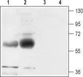 WB analysis of rat (lanes 1 and 3) and mouse (lanes 2 and 4) brain membrane lysates using GTX18175 EAAT1 antibody. Lane 1, 2 : Primary antibody Lane 3, 4 : Primary antibody preincubated with immunogen peptide Dilution : 1:500
