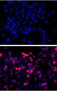 TOP: untransfected control; BOTTOM: anti-His (in red) on His-tagged fusion proteins in HEK293 cells. Both counterstained with DAPI (in blue)