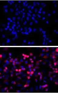 TOP: untransfected control; BOTTOM: anti-His (in red) on His-tagged fusion proteins in HEK293 cells. Both counterstained with DAPI (in blue) TOP: untransfected control; BOTTOM: anti-His (in red) on His-tagged fusion proteins in HEK293 cells. Both counterstained with DAPI (in blue)