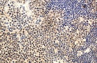 Immunohistochemistry with goat anti-IL-22 antibody on paraffin section of human tonsil