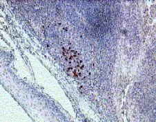 IHC analysis of human tonsil tissue using GTX18568 IL22 Receptor alpha 1 antibody.