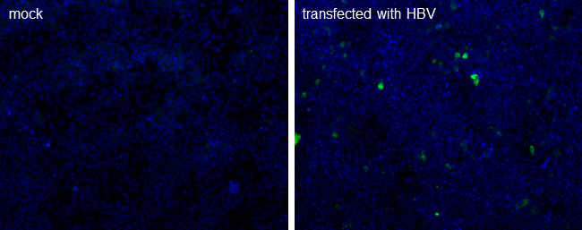 Hepatitis B core antigen antibody [10E11] detects Hepatitis B core antigen protein by immunofluorescent analysis.