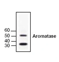 Western blot analysis of Armoatase in human brain cell lysate