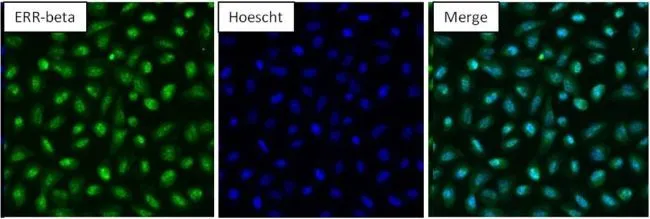 ICC/IF analysis of NRK cells using GTX19331 ERR beta antibody. Fixation : Formalin Permeabilization : 0.1% Triton X-100 in TBS for 10 minutes Dilution : 1:100 for at least 1 hour at room temperature ICC/IF analysis of NRK cells using GTX19331 ERR beta antibody. Fixation : Formalin Permeabilization : 0.1% Triton X-100 in TBS for 10 minutes Dilution : 1:100 for at least 1 hour at room temperature