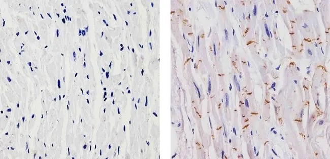 IHC-P analysis of human heart tissue using GTX19348 N-Cadherin antibody [8C11]. Right : Primary antibody Left : Negative control without primary antibody Antigen retrieval : 10mM sodium citrate (pH 6.0), microwaved for 8-15 min Dilution : 1:20