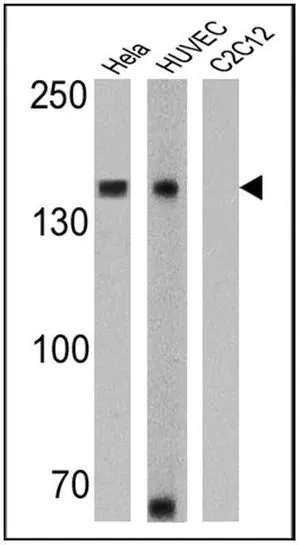 WB analysis of 25 ug of Hela (Lane 1), HUVEC (Lane 2), and C2C12 cell lysates (Lane 3) using GTX19348 N-Cadherin antibody [8C11]. Dilution : 1:1000 (Hela) and 1:500 (HUVEC and C2C12)
