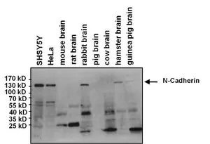WB analysis of 25 microg of various lysates using GTX19348 N-Cadherin antibody [8C11]. Dilution : 1:1000