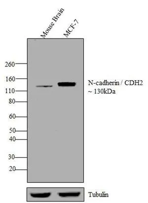 WB analysis of tissue lysate and whole cell extract (30 ug) of Mouse Brain (Lane 1) and MCF-7 (Lane 2) using GTX19348 N-Cadherin antibody [8C11]. Dilution : 1:1000