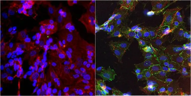ICC/IF analysis of SH-SY5Y cells using GTX19348 N-Cadherin antibody [8C11]. Cells were probed without (left) or with(right) an antibody. Green : Primary antibody Blue : Nuclei Red : Actin Fixation : Formalin Permeabilization : 0.1% Triton X-100 in TBS for 10 minutes Dilution : 1:100 for at least 1 hour at room temperature