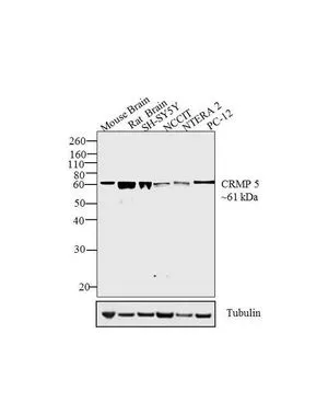 WB analysis of tissue whole cell extracts (30 microg lysate) of Mouse Brain (Lane 1), Rat Brain (lane 2), SH-SY5Y (lane 3), NCCIT (Lane 4), NTERA 2 (Lane 5), and PC 12 (lane 6) using GTX19378 CRMP5 antibody [CR-1]. Dilution : 1:1000