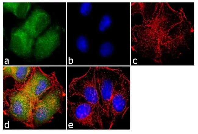 ICC/IF analysis of MCF-7 cells using GTX19389 Her3 / ErbB3 antibody [RTJ2]. Panel e is a no primary antibody control. Green : Primary antibody Blue : Nuclei Red : Actin Fixation : 4% paraformaldehyde Permeabilization : 0.1% Triton X-100 for 10 minute Dilution : 2 microg/ml in 0.1% BSA and incubated for 3 hours at room temperature