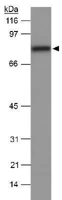 WB analysis of mouse liver tissue lysate using GTX20003 SR-BI antibody.