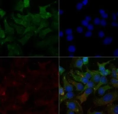 ICC/IF analysis of HeLa cells (fixed and permeabilized with MeOH) using GTX20003 SR-BI antibody. Green : primary antibody Red : Tubulin Blue : DAPI Dilution : 2 microg/ml