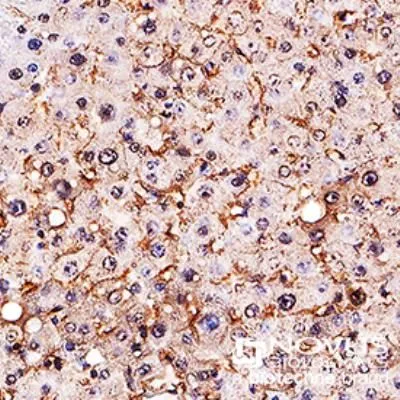 IHC-P analysis of human liver tissue using GTX20003 SR-BI antibody. Dilution : 1:300