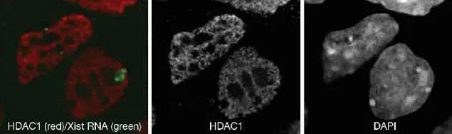 ICC/IF analysis of mouse differentiated ES cells using GTX20012 HDAC1 antibody. Subsequently, RNA FISH (fluorescence in situ hybridization) was performed to detect Xist RNA (green signal). Nuclei were DAPI-stained to specifically label the DNA. Fixation : formaldehyde Permeabilization : Triton X-100 Dilution : 1:200 and incubated for 45 minutes at room temperature