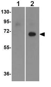 WB analysis of recombinant seasonal Hemagglutinin (lanes A & B) and swine-origin Hemagglutinin (lanes C & D) using anti-seasonal Hemagglutinin antibody (lanes A & C) and GTX20084 Swine Influenza A virus H1N1 HA (Hemagglutinin) . Working concentration : 2 microg/ml antibody (lanes B & D). WB analysis of recombinant seasonal Hemagglutinin (lanes A & B) and swine-origin Hemagglutinin (lanes C & D) using anti-seasonal Hemagglutinin antibody (lanes A & C) and GTX20084 Swine Influenza A virus H1N1 HA (Hemagglutinin) . Working concentration : 2 microg/ml antibody (lanes B & D).