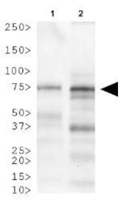 WB analysis of (1) human heart and (2) mouse heart tissue lysate using GTX20114 LIMP II antibody. WB analysis of (1) human heart and (2) mouse heart tissue lysate using GTX20114 LIMP II antibody.