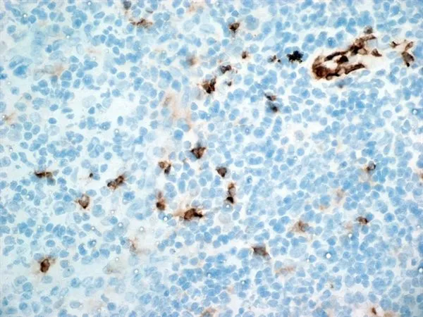 IHC-Fr analysis of human spleen tissue using GTX20183 CD11b antibody [ICRF44].