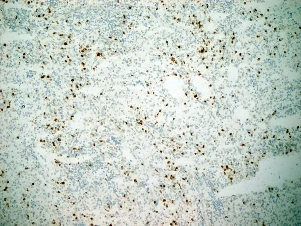 IHC-Fr analysis of human spleen tissue using GTX20183 CD11b antibody [ICRF44].