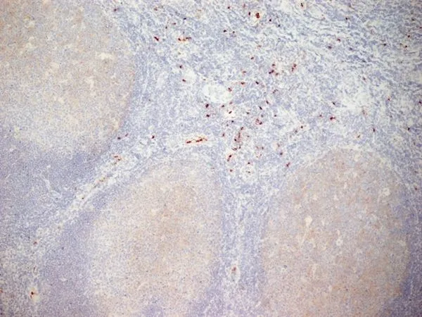 IHC-Fr analysis of human tonsil tissue using GTX20183 CD11b antibody [ICRF44].