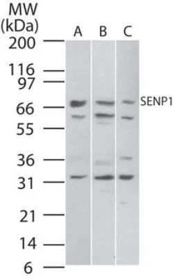 WB analysis of (A) Daudi,(B) HeLa and (C) NIH-3T3 cell lysates using GTX20254 SENP1 antibody.